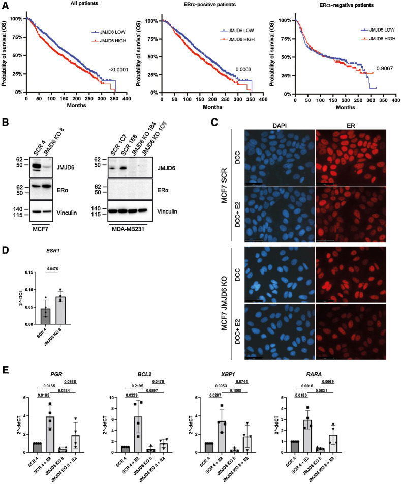 Figure 1. JMJD6 regulates ERα activity and affects prognosis in luminal patients with breast cancer. A, Kaplan–Meier analysis of patients with breast cancer included in the METABRIC dataset (available on cBioportal) showing the OS of all (left, n = 1,884), ERα-positive (middle, n = 1,440) or ERα-negative patients (right, N = 444). ‘High’ (red) and ‘low’ (blue) JMJD6 expression is shown according to median. P value was calculated with Log-rank (Mantel-Cox) test. B, Western blot showing the expression of JMJD6 and ERα in control (SCR) and JMJD6 KO MCF7 and MDA-MB231 clones. Vinculin is shown as loading control. C, Immunofluorescence staining of ERα (red) in scramble or JMJD6 KO MCF7 cells stimulated or not with E2. Nuclei were stained with DAPI (blue), bars = 50 μmol/L. D, Real Time PCR to evaluate the levels of ESR1 and (E) its target genes (PGR, BCL2, XBP1 and RARA) in control (SCR) of JMJD6 KO MCF7 stimulated or not with E2. Statistical significance was calculated by paired two-tailed t test comparing four independent experiments.