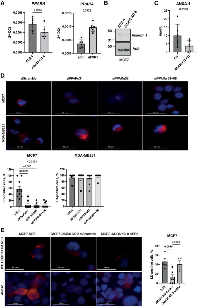 Figure 4. PPARα regulates LD droplet formation and ANXA1 levels via ERα signaling. A, Real time PCR showing the expression of PPARα in control and JMJD6 KO MCF7 clones (left) and in MCF7 silenced for ERα (right). Graphs show the average of six independent experiments. P values were calculated by paired two-tailed t test. B, Western blot showing the levels of ANXA1 in MCF7 control or JMJD6 KO clones. Actin-β was used as loading control. C, ANXA1 ELISA performed with CM from control (n = 6) and JMJD6 KD (n = 3) and KO (n = 3) collected in independent experiments. P values were calculated by paired two-tailed t test. D, Fluorescence images showing the presence of LDs (HCS LipidTOX RED) in MCF7 and MDA-MB231 cells silenced for PPARα. Nuclei were stained with DAPI (blue), bars = 20 μmol/L. Graphs show the percentage of LD-positive cells/field; cells from at least six independent fields were counted. Statistical significance was evaluated by ordinary one-way Anova, multiple comparisons test. E, Fluorescence images showing the presence of LDs and ANXA1 (red) in scramble and JMJD6 KO MCF7 cells silenced for ERα. Nuclei were stained with DAPI (blue), bars = 20 μmol/L. Graph shows the percentage of LD-positive cells/field; cells from at least four independent fields were counted. Statistical significance was evaluated by ordinary one-way Anova, multiple comparisons test.