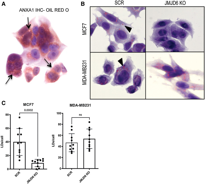 Figure 3. ANXA1 is accumulated in LDs. A, IHC staining of ANXA1 combined with Oil Red O staining of WT MCF7 cells. Black arrows show colocalization areas. B, Oil Red O stained scramble or JMJD6 KO MCF7 and MDA-MB231 cells. Black arrows show LDs. C, Quantification of LDs shown in panel B. P values were calculated by unpaired two-tailed t test.