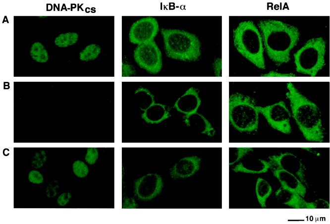 FIG. 11