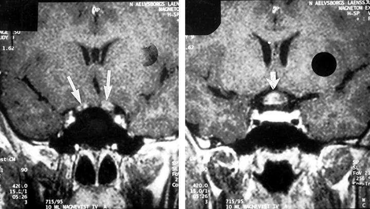 Figure 1  