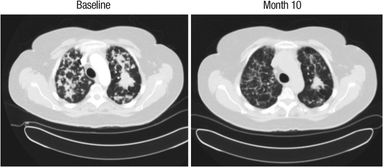 Fig. 3