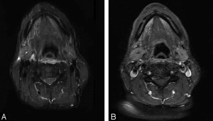 Fig 2.