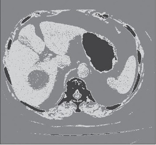 Figure 4b