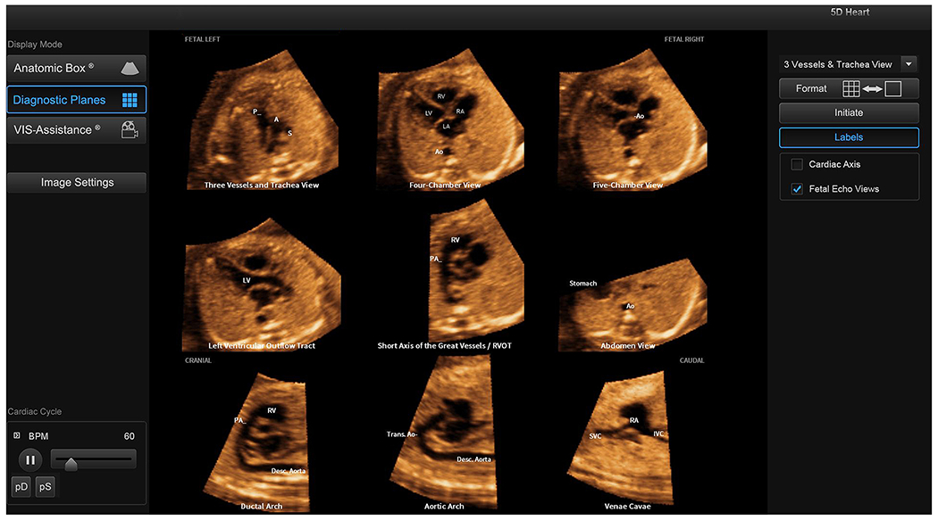 Figure 2: