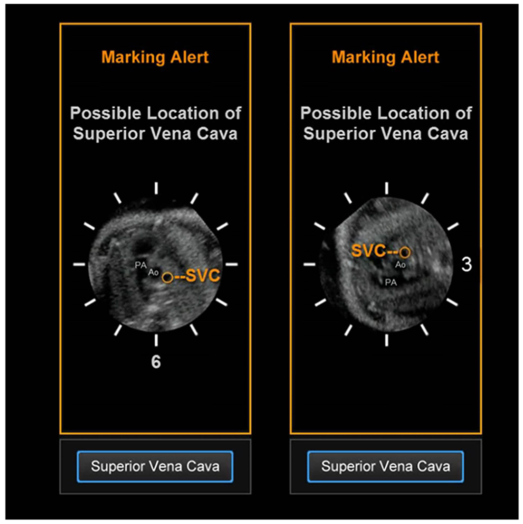 Figure 3: