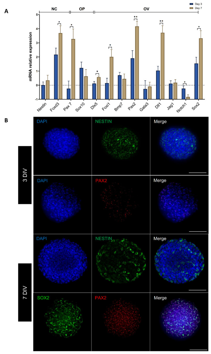 Differentiation Of Spiral Ganglion Neurons From Human Dental Pulp Stem