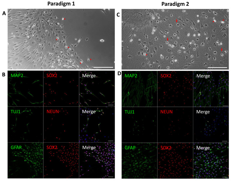 Differentiation Of Spiral Ganglion Neurons From Human Dental Pulp Stem