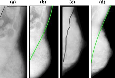 Fig. 7