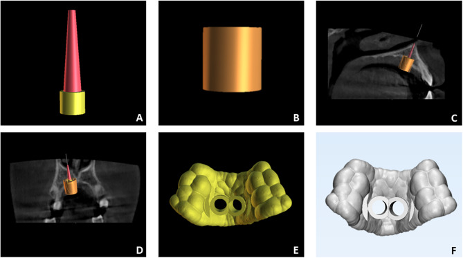 Fig. 1