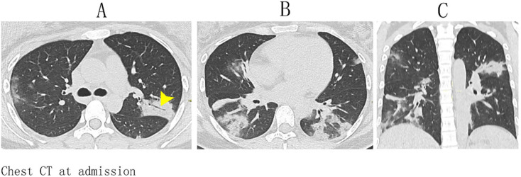 Fig. 1