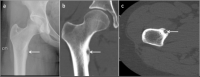 Figure 12.