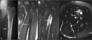 Figure 13.