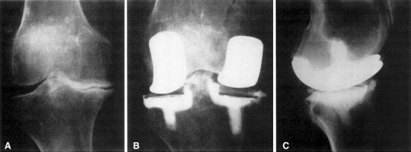 Fig. 2A–C