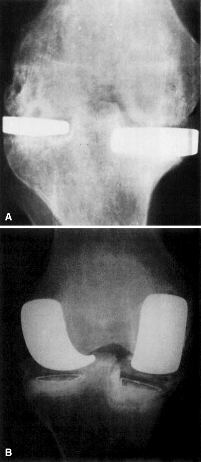 Fig. 3A–B