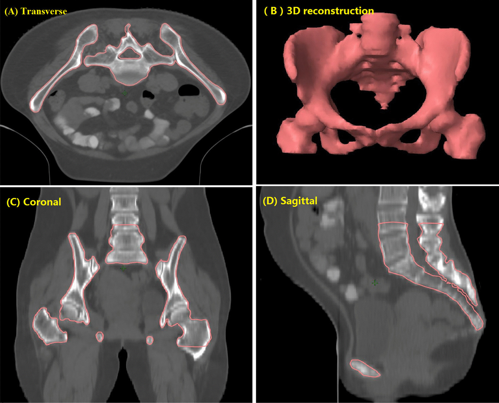 Fig. 1