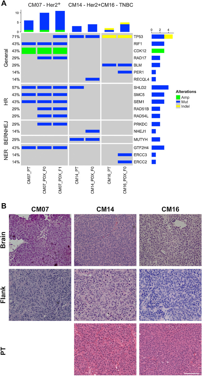 Figure 1. Characterization of brain metastasis PDX models. A, Oncoprint of DNA damage repair genomic alterations found in PDXs and their original PT. The three PDX models and their original PT were previously characterized by whole-exome sequencing. Genetic alterations across 126 DDR genes in various repair pathways were identified in the PT and PDX. Only genes with alterations are shown in the figure. B, H&E staining of PDX tumors implanted subcutaneously into the flank and by intracardiac injection into the brain, along with the PT. Tumor histology was consistent in PDX models implanted in the flank, brain and PT. Scale bar represents 100 μm.