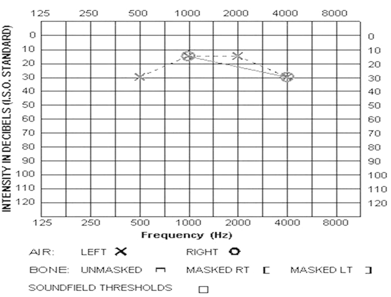 Figure 13