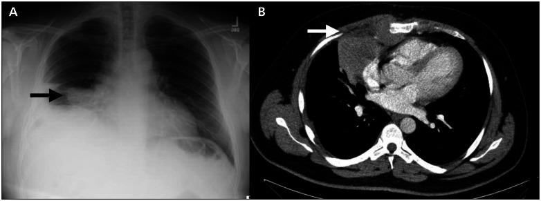 Figure 1: