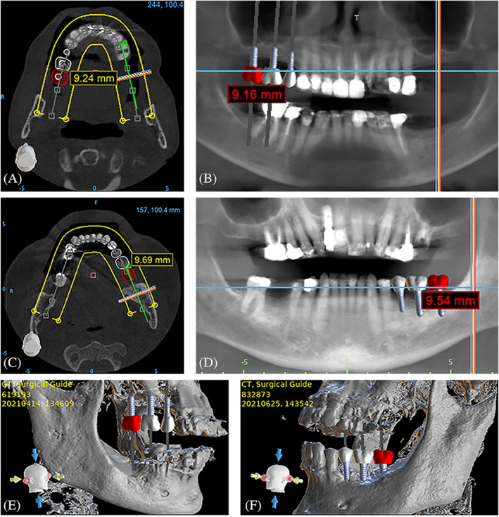 FIGURE 2