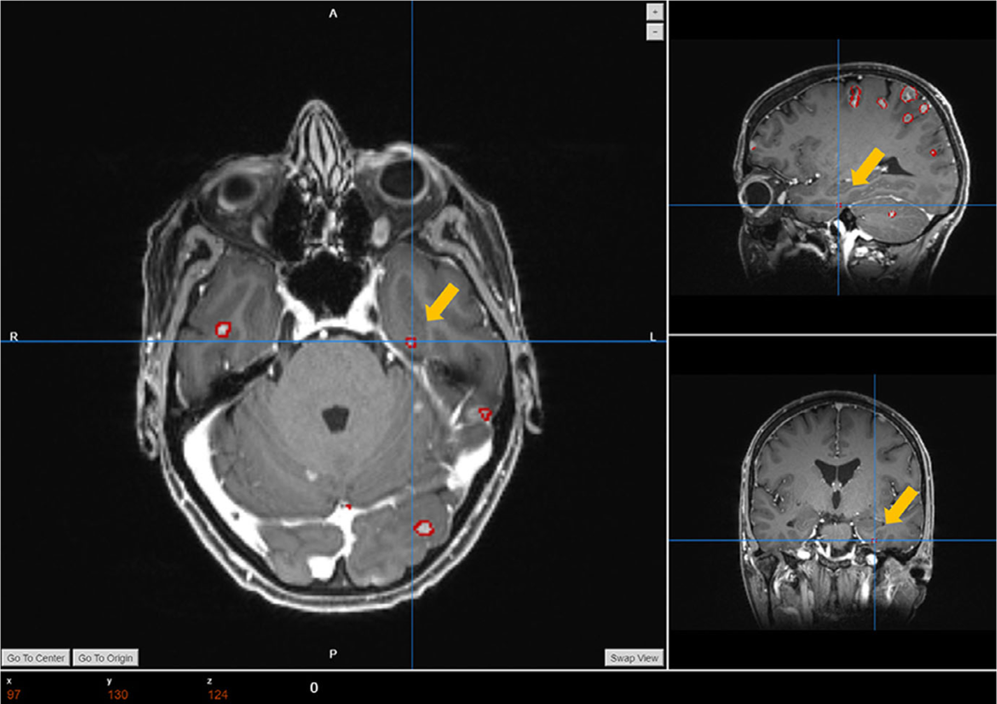 FIG. 10.