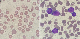 Fig 1.