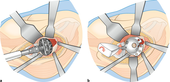 graphic file with name 64_2023_834_Fig5_HTML.jpg