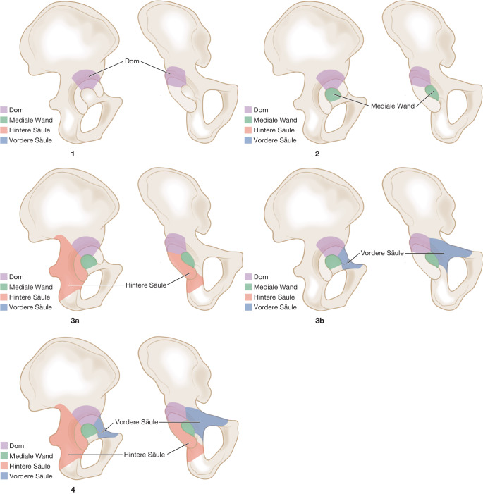 graphic file with name 64_2023_834_Fig1_HTML.jpg