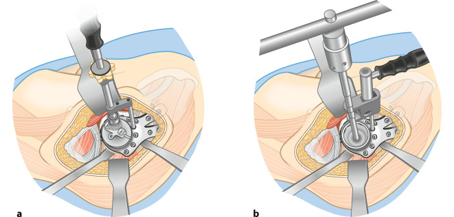 graphic file with name 64_2023_834_Fig9_HTML.jpg