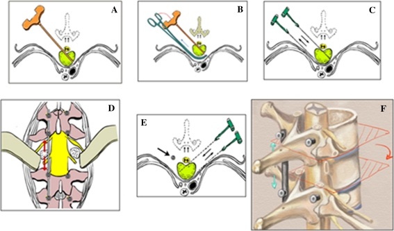 Fig. 2