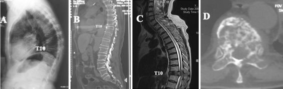 Fig. 1