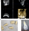 Fig. 1