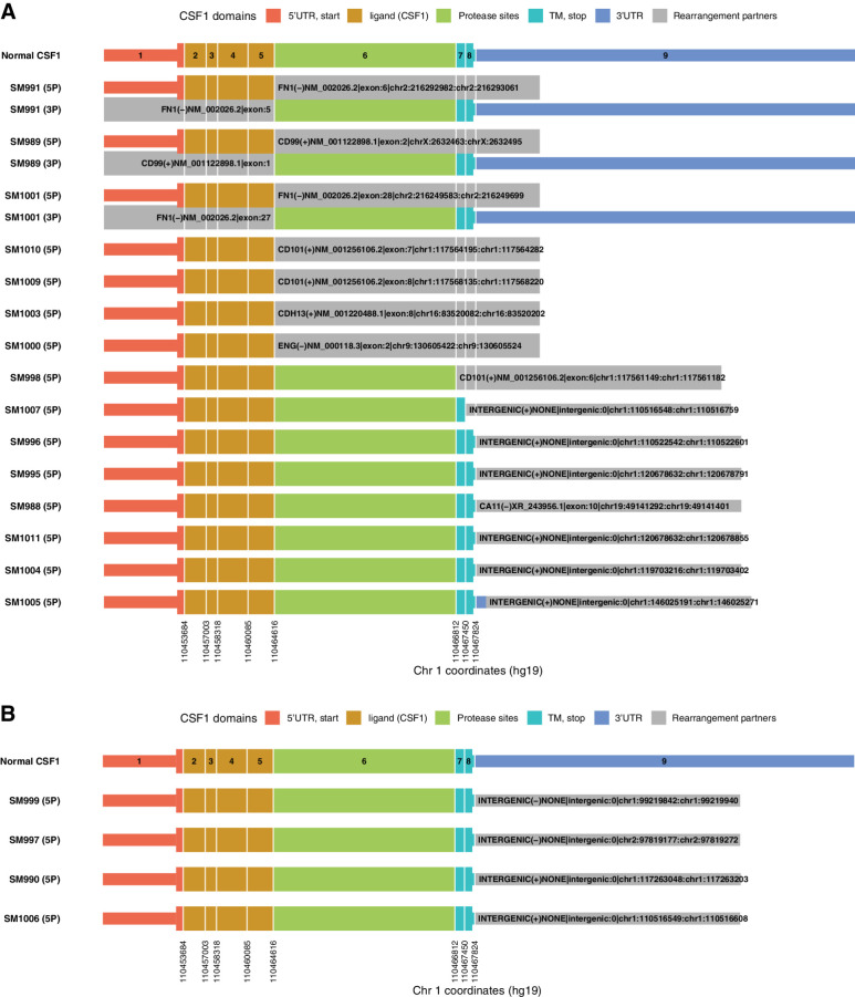 Figure 4. TGCT biopsy-targeted RNA-seq identified abnormal CSF1 transcripts. Ten specimens showed evidence of alteration at exon 8 or within the 3′UTR, with 6 strong-evidence events (A) and 4 low-confidence events (B). CA11, carbonic anhydrase 11; CD101, CD101 molecule; CD99, CD99 molecule (Xg blood group); CDH13, cadherin 13; Chr, chromosome; CSF1, colony-stimulating factor 1; ENG, endoglin; FN1, fibronectin 1; SM, sample; TGCT, tenosynovial giant cell tumor; TM, transmembrane; UTR, untranslated region.