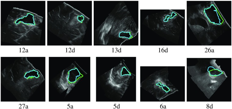 Fig. 11