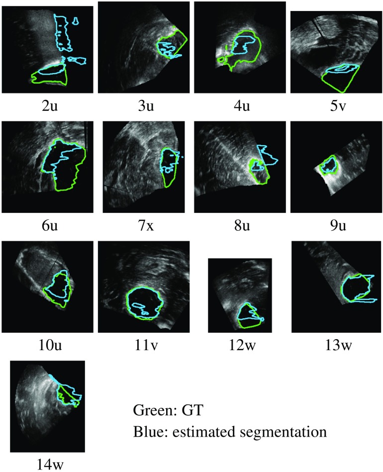 Fig. 13