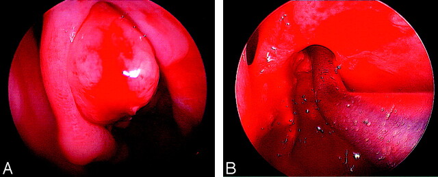 Fig 4.