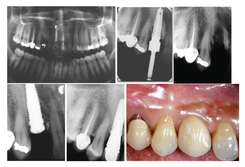 Fig. (1)