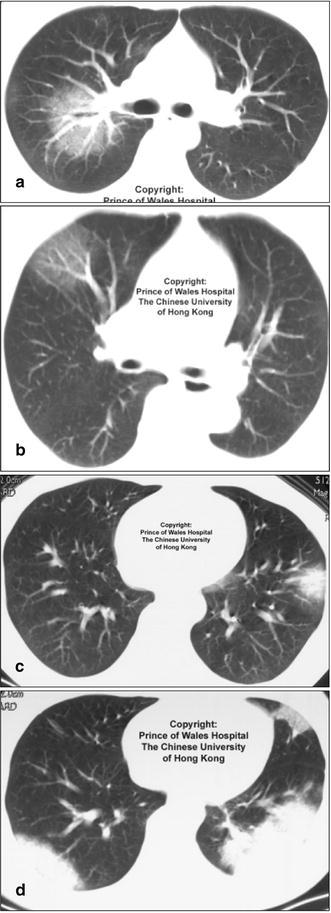 Fig. 22a–d