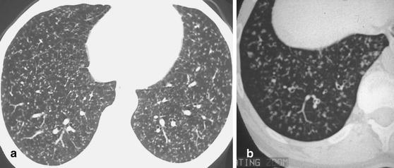 Fig. 20a,b