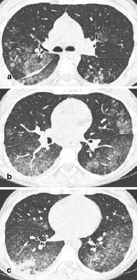 Fig. 14a–c