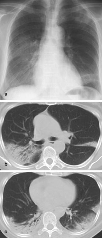 Fig. 26a–c