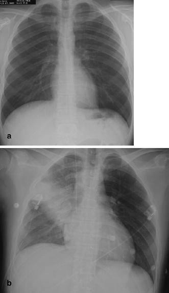 Fig. 1a,b