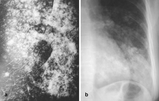 Fig. 12a,b