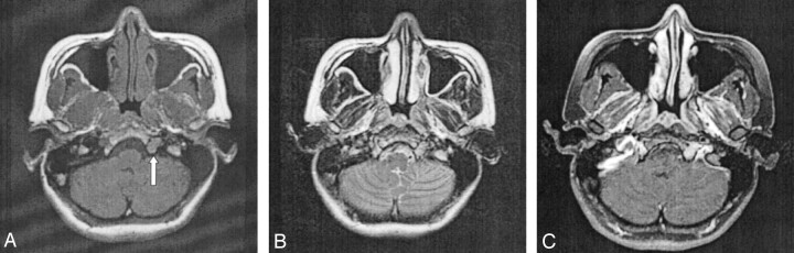 Fig 2.