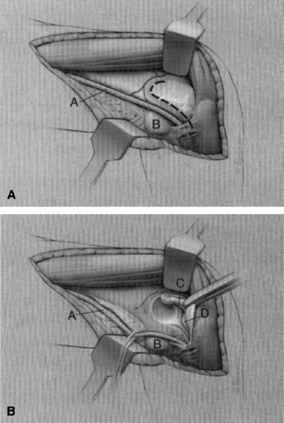 graphic file with name jbjsest-2-e09-g010.jpg