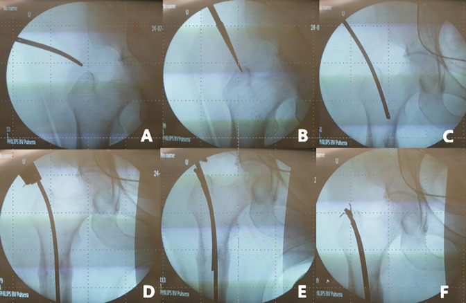 Figure 4.