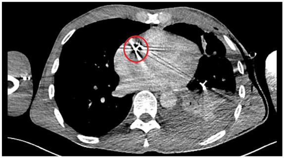 Figure 3.