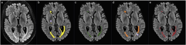 Fig. 4