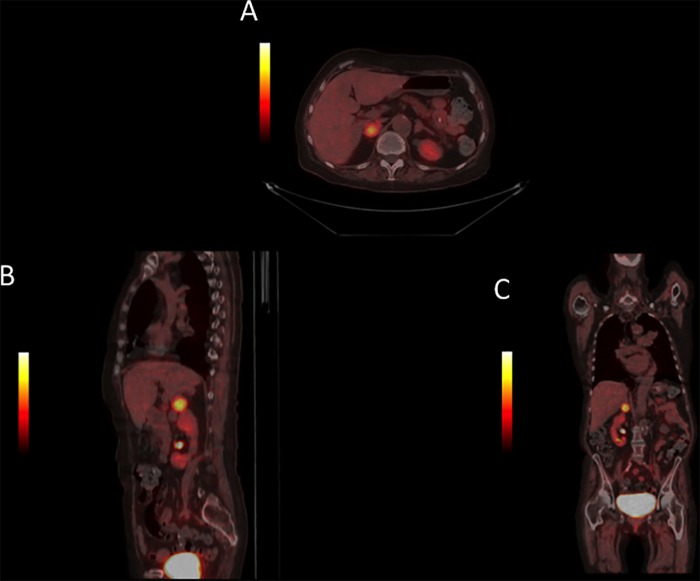 Figure 1