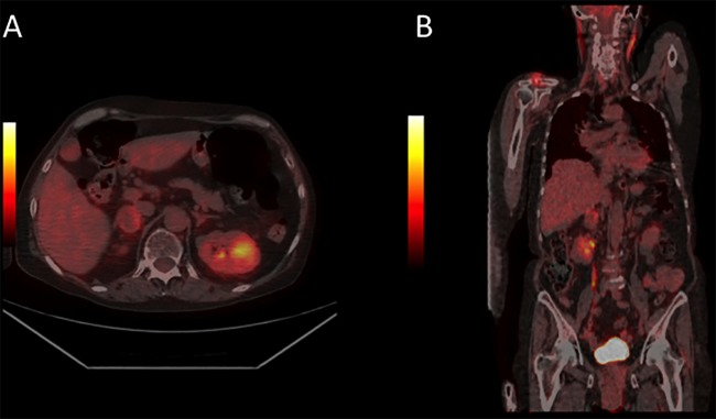 Figure 2